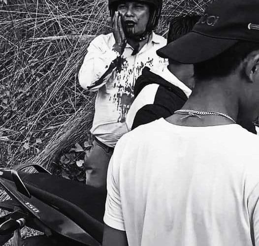 प्र अ प्रेम बहादुर बोम्जन माथि अज्ञात समुह द्वारा  गोलि प्रहार